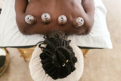 man recieving cupping therapy.
